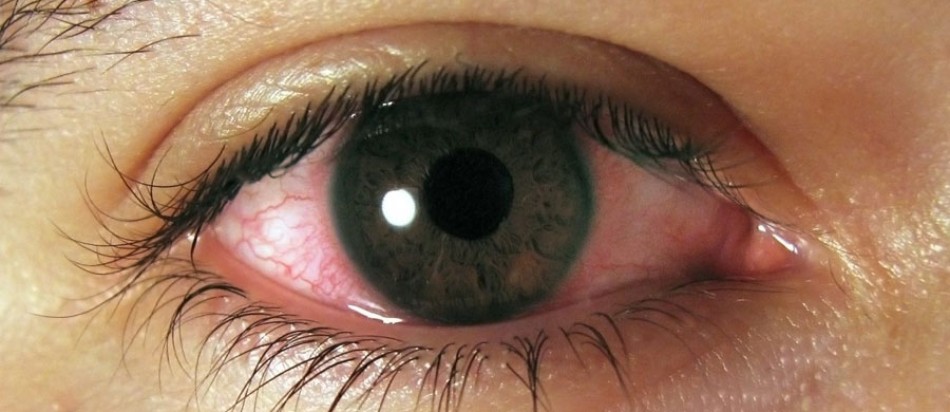 Los entrenamientos del Plantel Superior se ven afectados ante la cantidad de casos de conjuntivitis